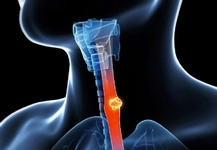 Yemek Borusu Anatomisi Nasıldır? Yemek Borusu Anatomisi Nasıldır?